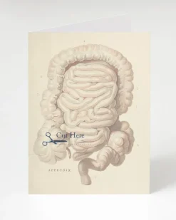 Cognitive Surplus Appendex Surgery Card - Science Stationery | * Greeting Cards | Medicine