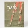 Cognitive Surplus Get Well Card - Broken Leg Stationery | * Greeting Cards | Medicine
